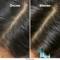 Scalp Advanced Yağlanma Karşıtı Profesyonel Şampuan 500 ml