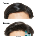 Scalp Advanced Yağlanma Karşıtı Profesyonel Şampuan 500 ml